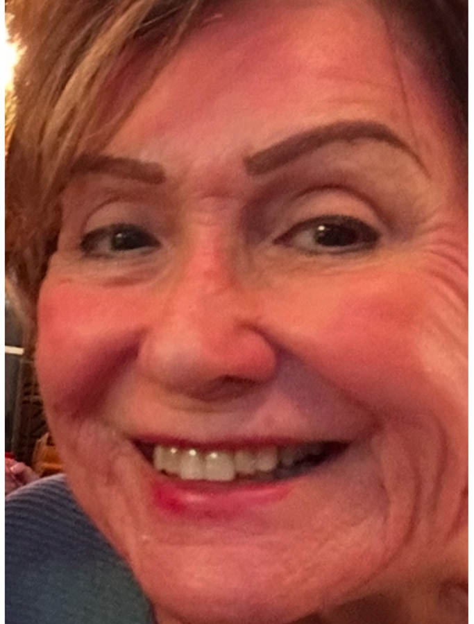 After Image: Patient Case #18121 - left-front-oblique