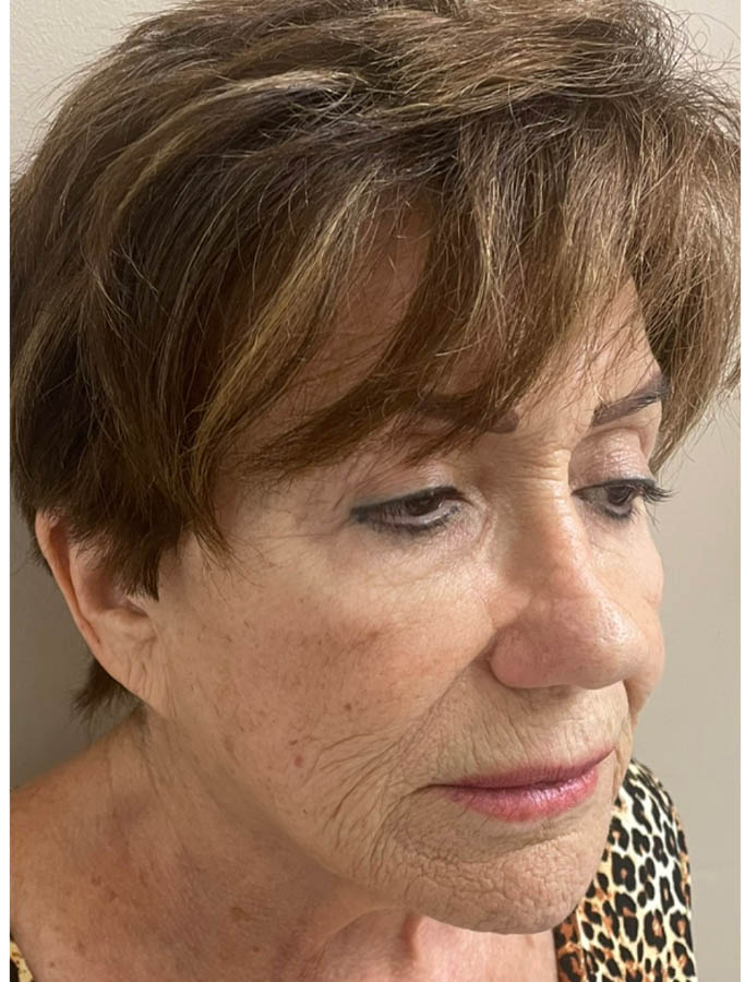 Before Image: Patient Case #18121 - right-front-oblique